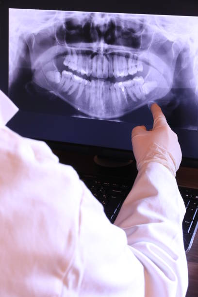 Best Emergency Dentist for Knocked-Out Tooth in Miami Heights, OH